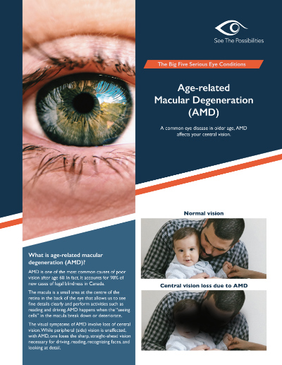 Age-related macular degeneration (AMD) thumbnail